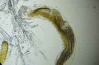 Coleophora lixella