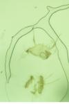 Lobesia indusiana/limoniana