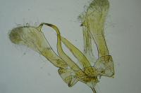 Parornix torquillella