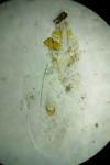Endothenia ericetana