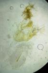 Cnephasia genitalana