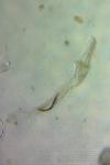 Coleophora alcyonipennella