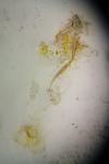 Coleophora currucipennella