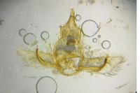 Cnephasia