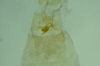 Aproaerema albifrontella