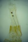 Agnoea langohri