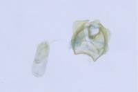 Ectoedemia haraldi