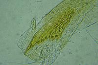 Elachista agelensis