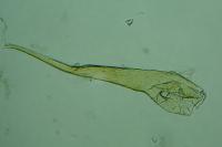 Infurcitinea atrifasciella