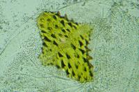Agnoea josephinae