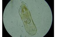 Ectoedemia pubescivora
