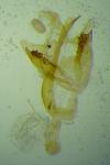 Coleophora lutipennella