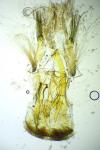 Teleiopsis diffinis