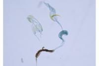 Coleophora potentillae