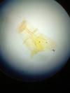 Phyllonorycter ulmifoliella