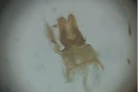 Acleris schalleriana