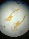 Scrobipalpa atriplicella