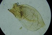 Monochroa rumicetella