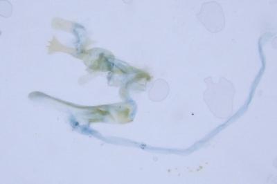 Alucita bidentata
