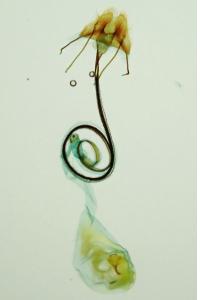 Coleophora vibicella