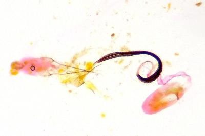 Coleophora paucinotella