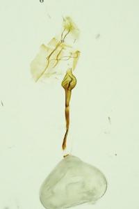 Rhigognostis annulatella
