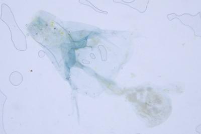 Hellinsia tephradactyla