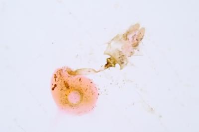 Acleris ferrugana