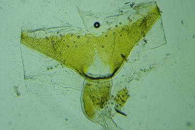 Cnephasia genitalana
