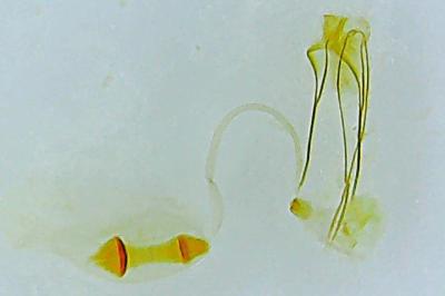 Ypsolopha parenthesella