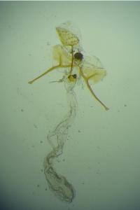 Metzneria paucipunctella