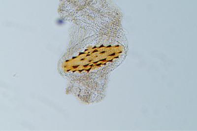 Agonopterix subpropinquella