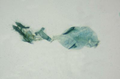 <i>Ancylis tineana</i>