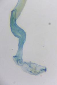 Coleophora peribenanderi