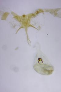 Aroga velocella