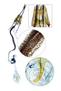 Coleophora alcyonipennella